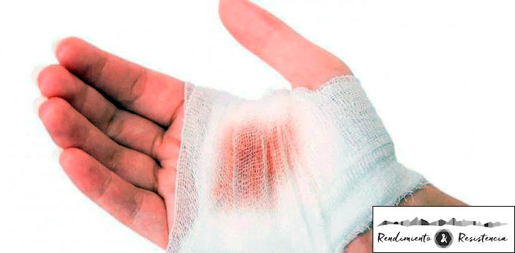 Glutamina para curar heridas en la mano