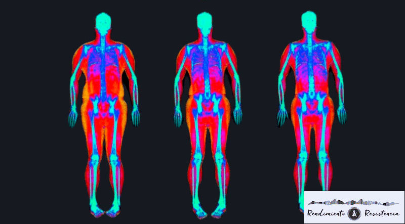 Escaner DEXA